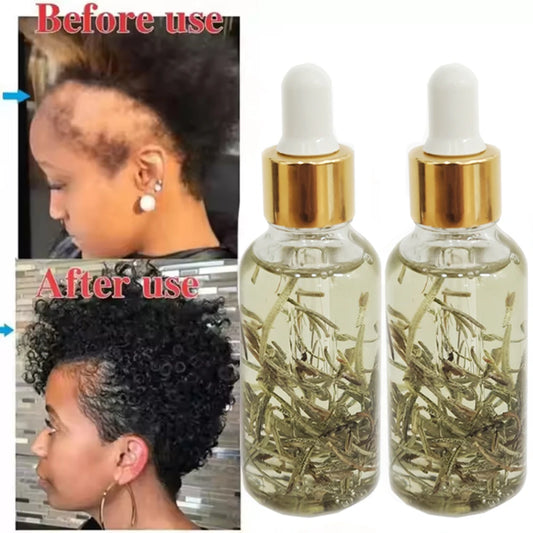 100% Natural Regrowth Oil