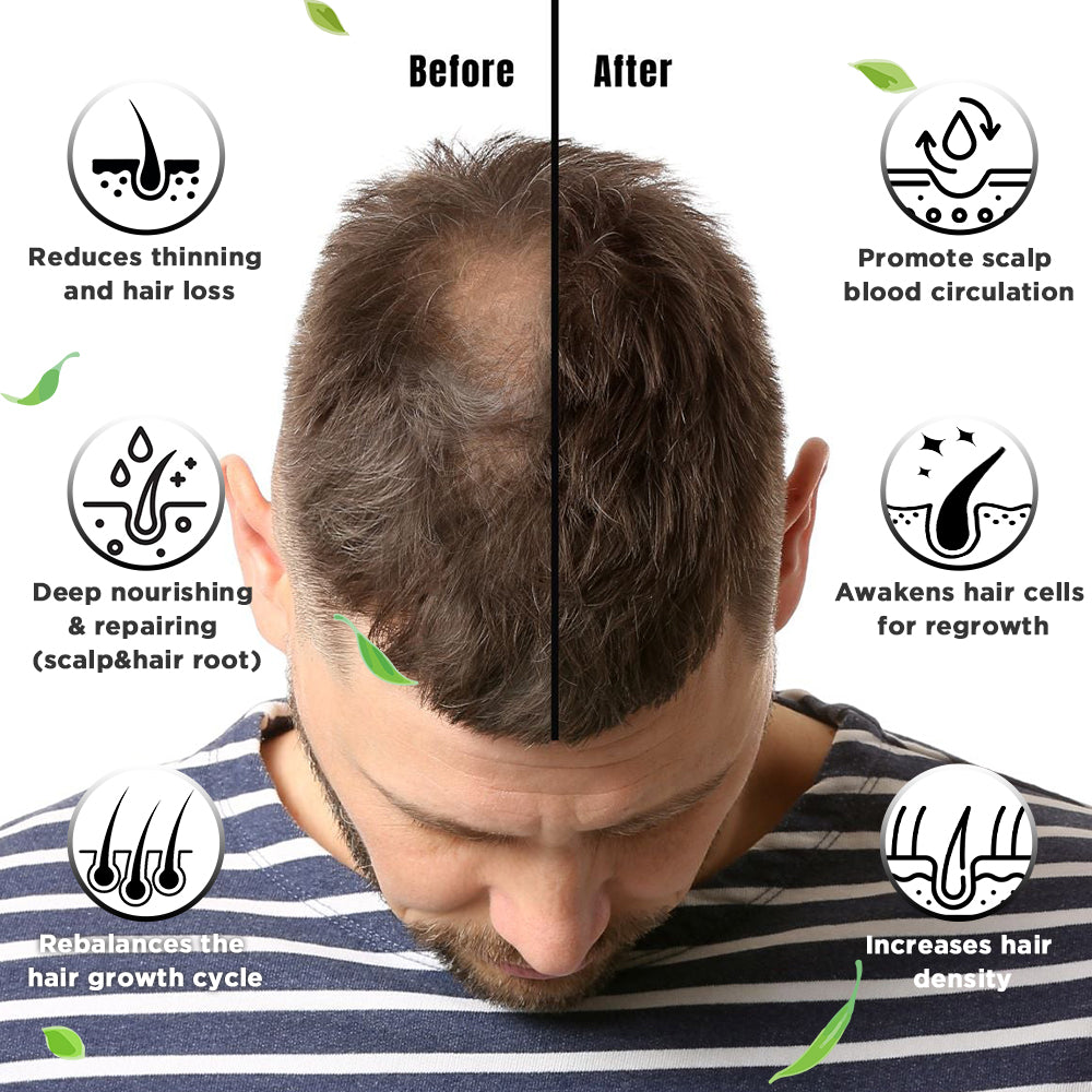 Rosemary essential oil